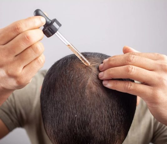 Эффективный миноксидил: растим волосы